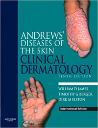 Image of Andrews' Diseases Of The Skin : Clinical Dermatology
